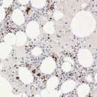 Immunohistochemical staining of human bone marrow shows strong nuclear positivity in hematopoietic cells.