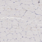 Immunohistochemical staining of human skeletal muscle shows no positivity in myocytes as expected.