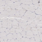 Immunohistochemical staining of human skeletal muscle shows no positivity in myocytes as expected.