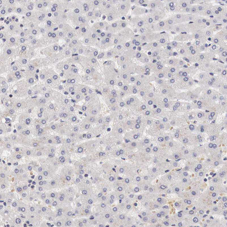 Rabbit Polyclonal AntiGATA1 Antibody Buy for research Highly