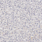 Anti-GATA1 Antibody