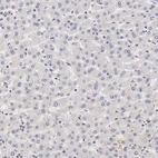 Immunohistochemical staining of human liver shows no positivity in hepatocytes as expected.