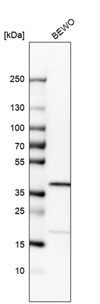 Western blot analysis in human cell line BEWO.