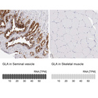 Anti-GLA Antibody