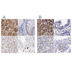 Immunohistochemical staining of human adrenal gland, colon, liver and testis using Anti-GLA antibody HPA000237 (A) shows similar protein distribution across tissues to independent antibody HPA000966 (B).
