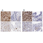 Immunohistochemical staining of human adrenal gland, colon, liver and testis using Anti-GLA antibody HPA000237 (A) shows similar protein distribution across tissues to independent antibody HPA000966 (B).