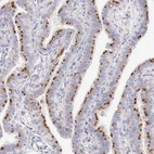 Immunohistochemical staining of human fallopian tube shows moderate positivity in lysosomes in glandular cells.