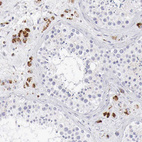 Anti-GLA Antibody