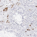 Immunohistochemical staining of human testis shows moderate positivity in lysosomes in Leydig cells.
