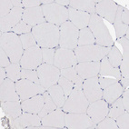 Immunohistochemical staining of human skeletal muscle shows no positivity in myocytes as expected.