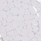 Immunohistochemical staining of human skeletal muscle shows no positivity in myocytes as expected.