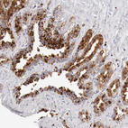 Anti-GLA Antibody