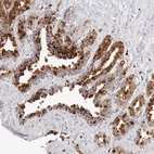 Immunohistochemical staining of human seminal vesicle shows moderate to strong positivity in lysosomes in glandular cells.