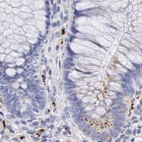 Immunohistochemical staining of human colon using Anti-GLA antibody HPA000237.