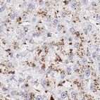 Anti-GLA Antibody