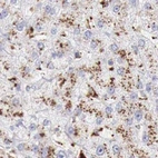 Immunohistochemical staining of human liver using Anti-GLA antibody HPA000237.