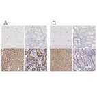 Immunohistochemical staining of human cerebral cortex, kidney, liver and small intestine using Anti-OTC antibody HPA000243 (A) shows similar protein distribution across tissues to independent antibody HPA000570 (B).