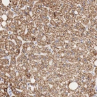 Immunohistochemical staining of human liver shows strong granular cytoplasmic positivity in hepatocytes.