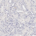 Anti-OTC Antibody