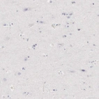 Immunohistochemical staining of human cerebral cortex shows no positivity in neurons as expected.