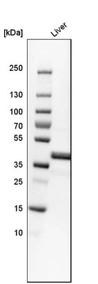 Western blot analysis in human liver tissue.
