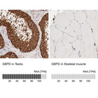 Anti-G6PD Antibody