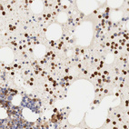 Immunohistochemical staining of human bone marrow shows strong cytoplasmic positivity in hematopoietic cells.