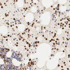 Anti-G6PD Antibody