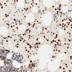 Immunohistochemical staining of human bone marrow shows strong cytoplasmic positivity in hematopoietic cells.