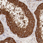 Anti-G6PD Antibody