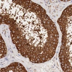 Immunohistochemical staining of human testis shows strong cytoplasmic positivity in cells in seminiferous ducts.