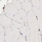 Immunohistochemical staining of human skeletal muscle shows no positivity in myocytes.