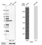 Western blot analysis in human cell lines A-549 and HEK293 using Anti-G6PD antibody. Corresponding G6PD RNA-seq data are presented for the same cell lines. Loading control: Anti-HSP90B1.