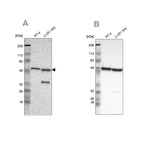 Anti-G6PD Antibody