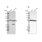 Western blot analysis using Anti-G6PD antibody HPA000247 (A) shows similar pattern to independent antibody HPA000834 (B).