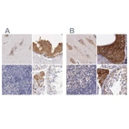 Immunohistochemical staining of human cerebral cortex, epididymis, lymph node and testis using Anti-NSDHL antibody HPA000248 (A) shows similar protein distribution across tissues to independent antibody HPA000571 (B).