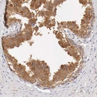 Immunohistochemical staining of human epididymis shows high expression.