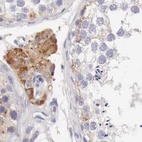 Anti-NSDHL Antibody