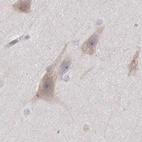 Anti-NSDHL Antibody