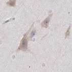 Immunohistochemical staining of human cerebral cortex using Anti-NSDHL antibody HPA000248.