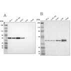 Anti-NSDHL Antibody