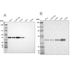 Western blot analysis using Anti-NSDHL antibody HPA000248 (A) shows similar pattern to independent antibody HPA000571 (B).