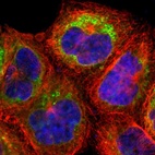Immunofluorescent staining of human cell line A-431 shows localization to endoplasmic reticulum & lipid droplets.