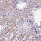 Anti-CHRDL1 Antibody