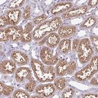 Immunohistochemical staining of human kidney shows strong cytoplasmic-membranous positivity in cells in tubules.