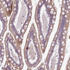 Immunohistochemical staining of human small intestine shows moderate cytoplasmic-membranous positivity in glandular cells.