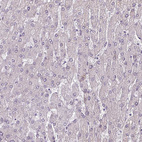 Immunohistochemical staining of human liver shows negative cytoplasmic positivity in hepatocytes as expected.