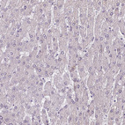 Anti-CHRDL1 Antibody