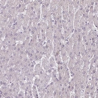 Immunohistochemical staining of human liver shows negative cytoplasmic positivity in hepatocytes as expected.