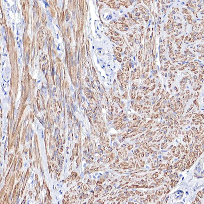 Anti-TPM1 Antibody